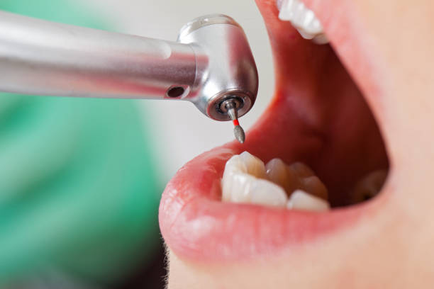 Best Cracked Tooth Emergency Dentist  in Three Oaks, FL
